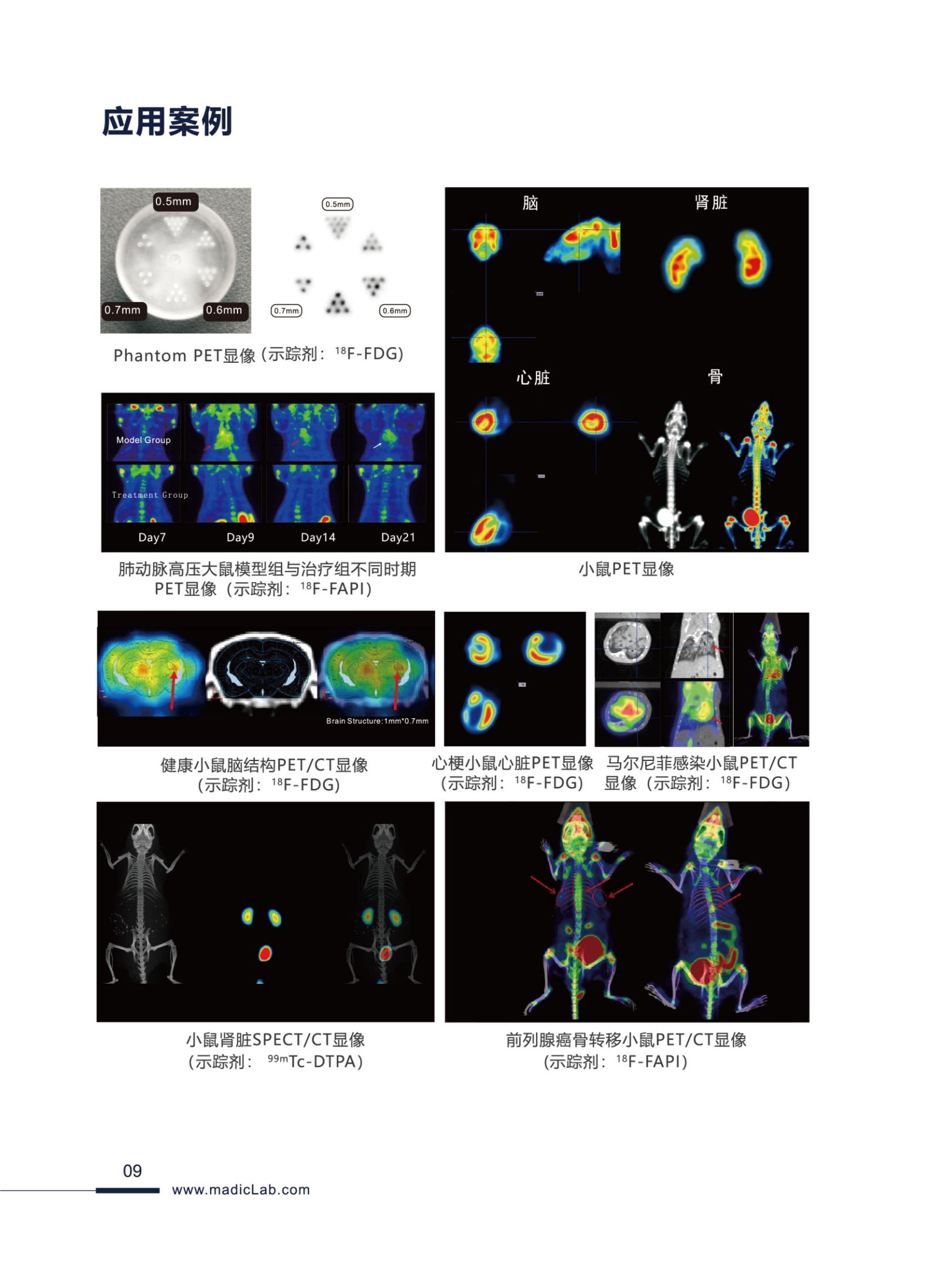 麦德盈华_PSA PET-SPECT-CT_2023MPV 072710.Jpg